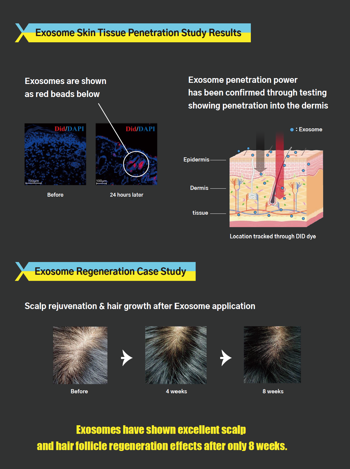 Exosome (2vials in 1 set) _2XSOME - Image 8